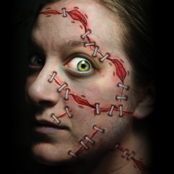 Trauma tattoos stapled